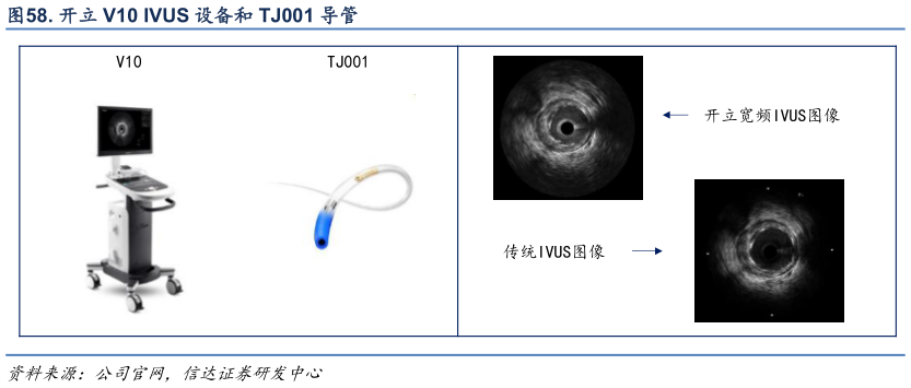 想关注一下. 开立 V10 IVUS 设备和 TJ001 导管