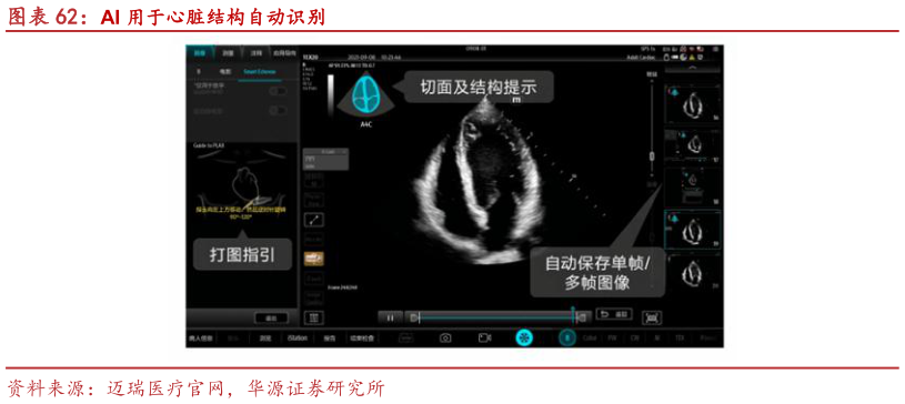 谁知道AI 用于心脏结构自动识别