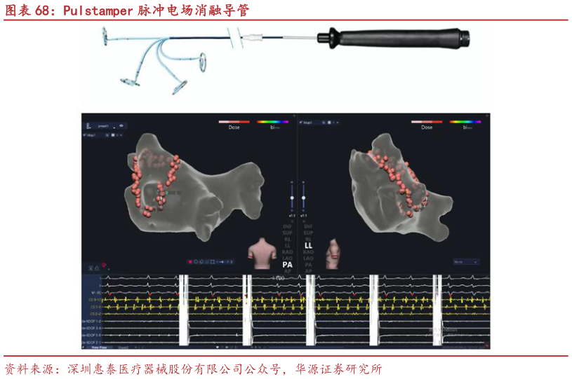 我想了解一下Pulstamper 脉冲电场消融导管