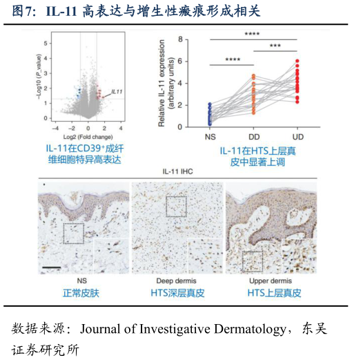 请问一下IL-11 高表达与增生性瘢痕形成相关