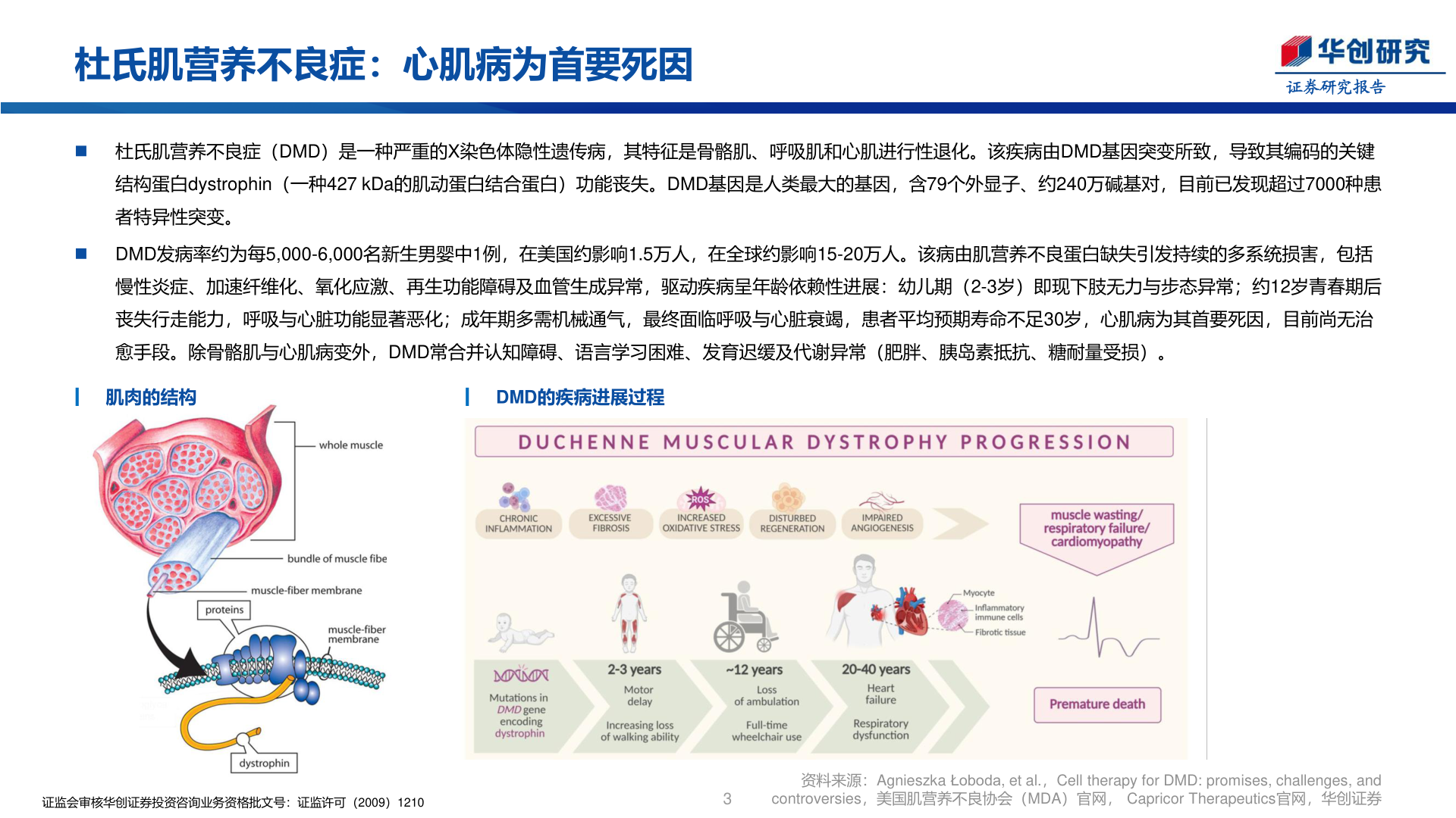 如何看待杜氏肌营养不良症：心肌病为首要死因