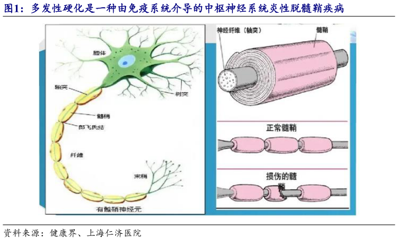 如何了解多发性硬化是一种由免疫系统介导的中枢神经系统炎性脱髓鞘疾病