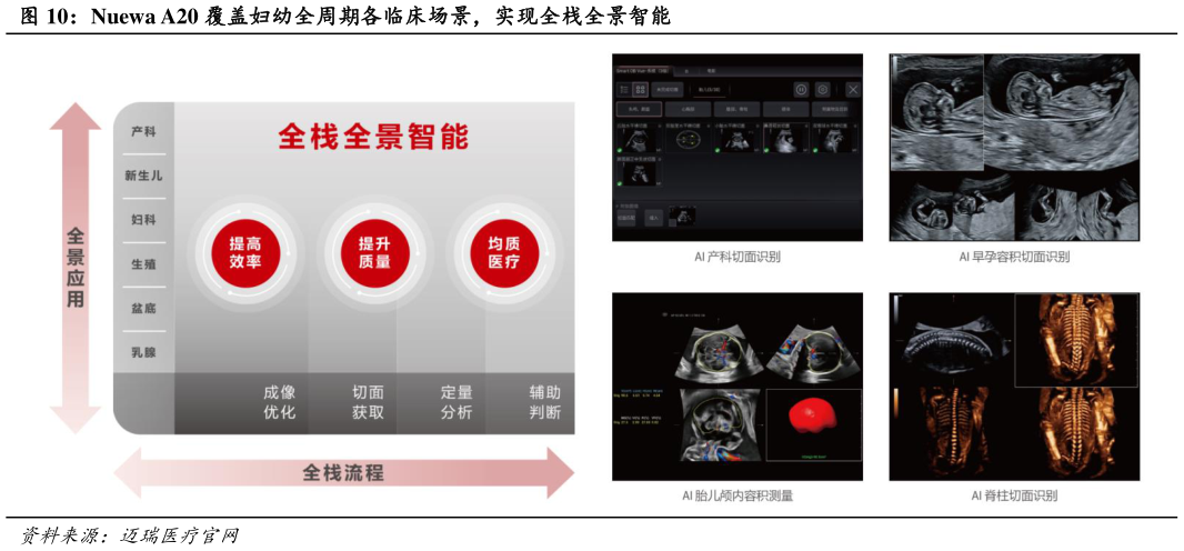 咨询下各位Nuewa A20 覆盖妇幼全周期各临床场景，实现全栈全景智能?