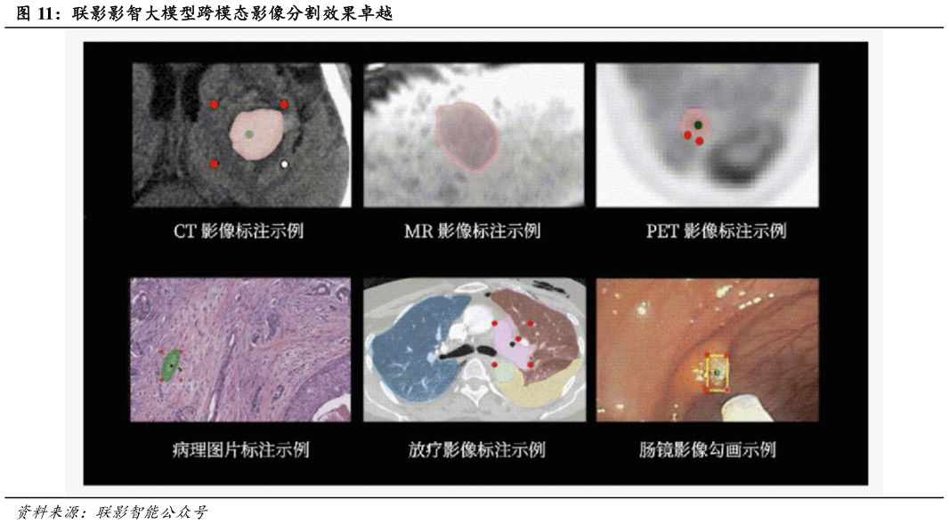 想问下各位网友联影影智大模型跨模态影像分割效果卓越?