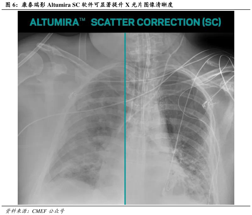 谁知道康泰瑞影 Altumira SC 软件可显著提升 X 光片图像清晰度?