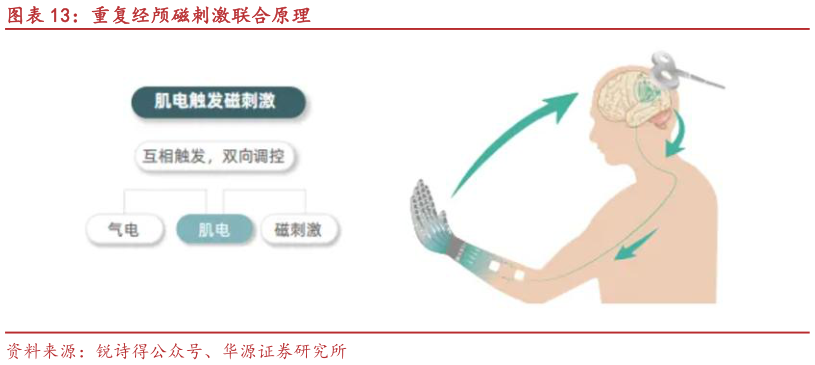 我想了解一下重复经颅磁刺激联合原理?