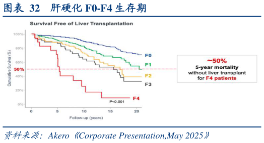 如何了解肝硬化 F0-F4 生存期?