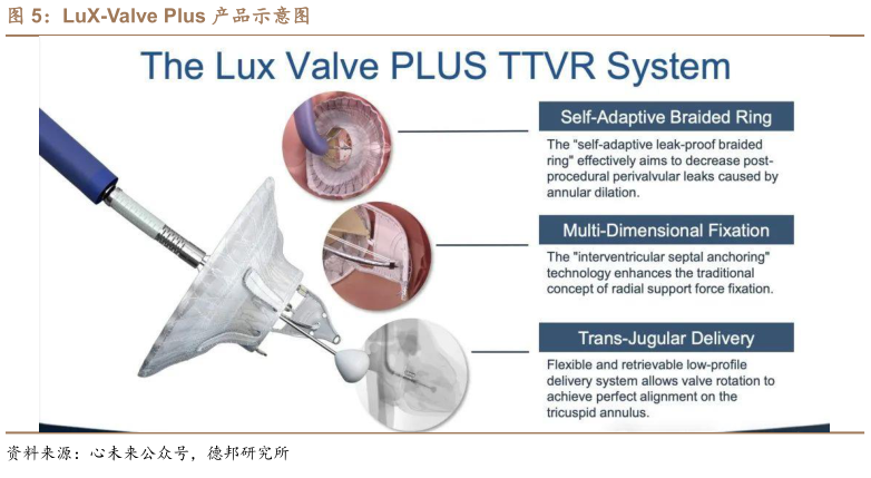 如何了解LuX-Valve Plus 产品示意图?