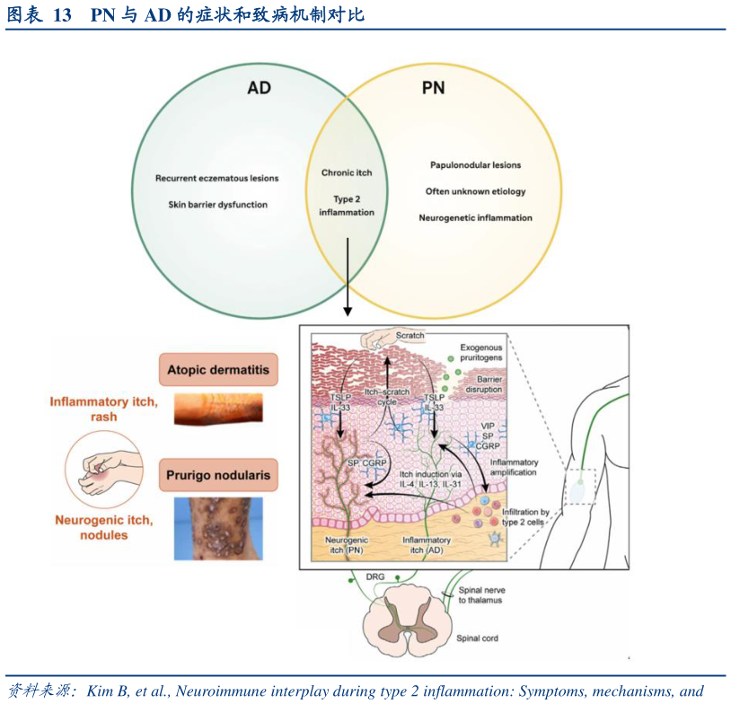 想关注一下PN 与 AD 的症状和致病机制对比