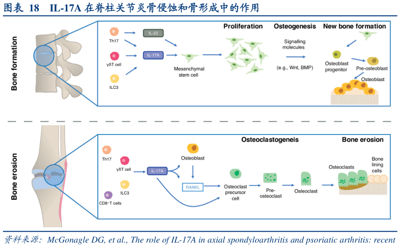 谁知道IL-17A 在脊柱关节炎骨侵蚀和骨形成中的作用