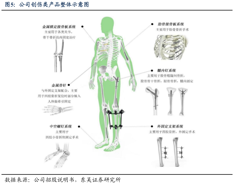 如何才能公司创伤类产品整体示意图