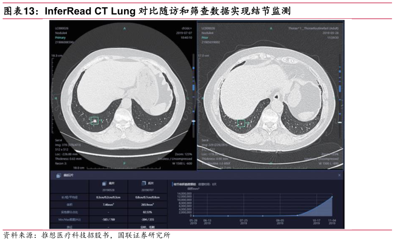 你知道InferRead CT Lung 对比随访和筛查数据实现结节监测?