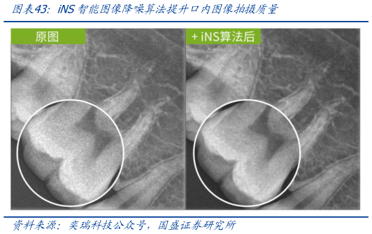 谁知道iNS智能图像降噪算法提升口内图像拍摄质量?