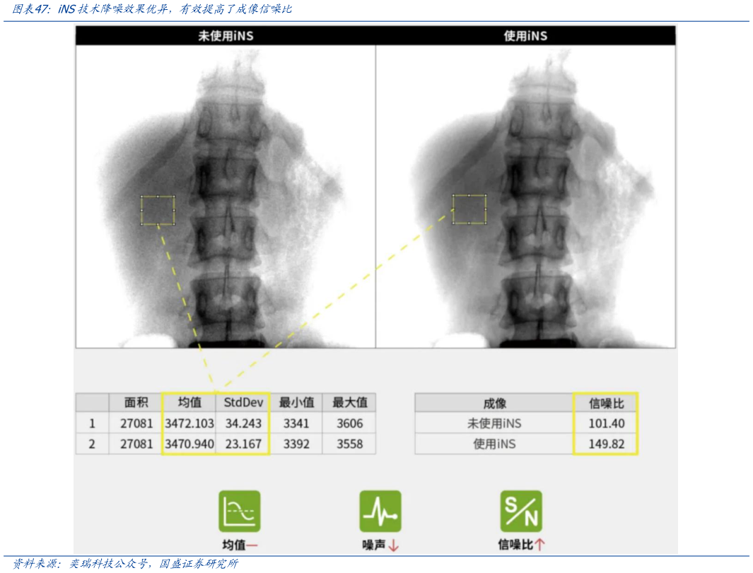 请问一下iNS技术降噪效果优异，有效提高了成像信噪比?