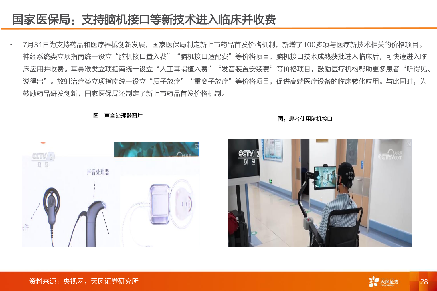 想问下各位网友国家医保局:支持脑机接口等新技术进入临床并收费?