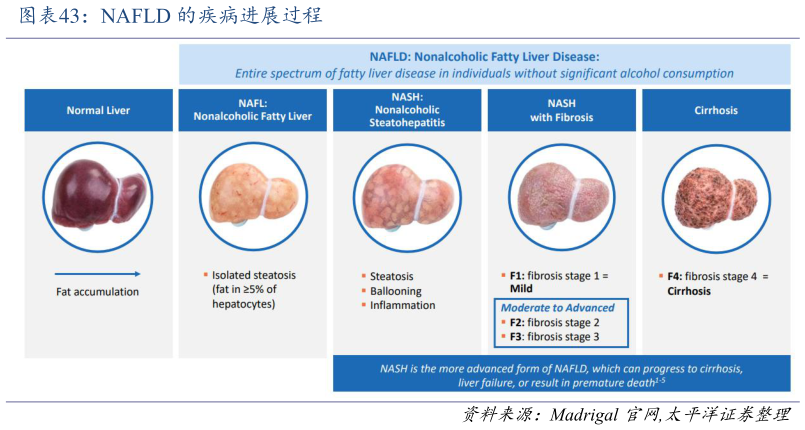 如何了解NAFLD 的疾病进展过程
