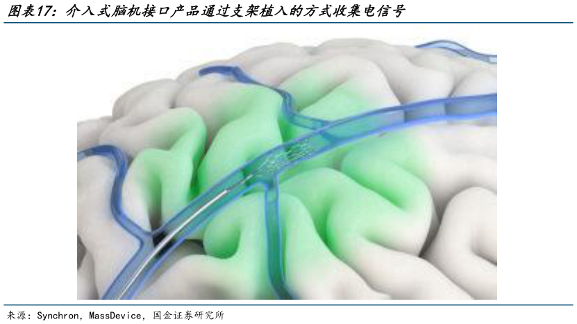 一起讨论下介入式脑机接口产品通过支架植入的方式收集电信号