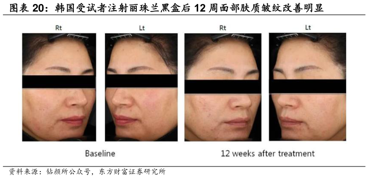 咨询大家韩国受试者注射丽珠兰黑盒后 12 周面部肤质皱纹改善明显
