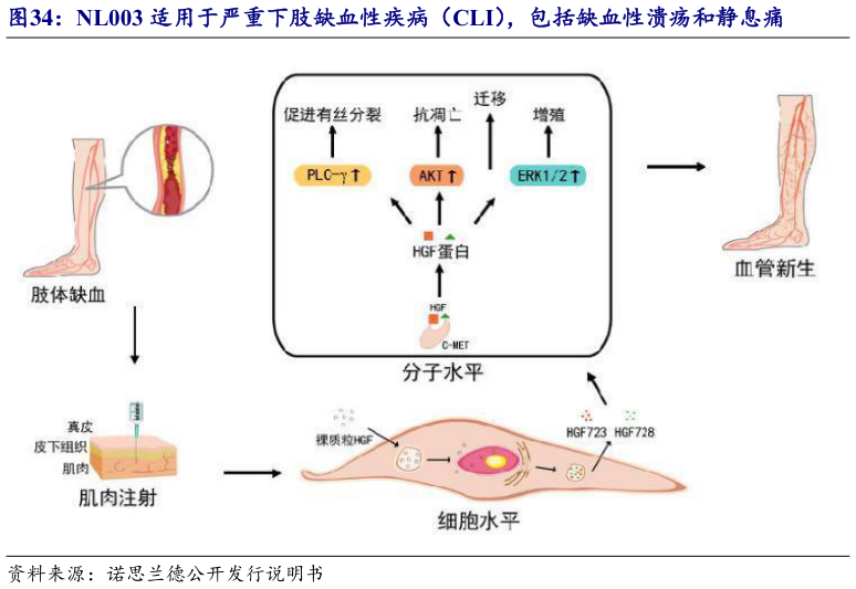 怎样理解NL003 适用于严重下肢缺血性疾病（CLI），包括缺血性溃疡和静息痛