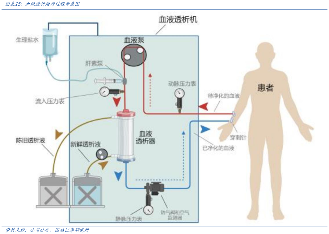 怎样理解血液透析治疗过程示意图