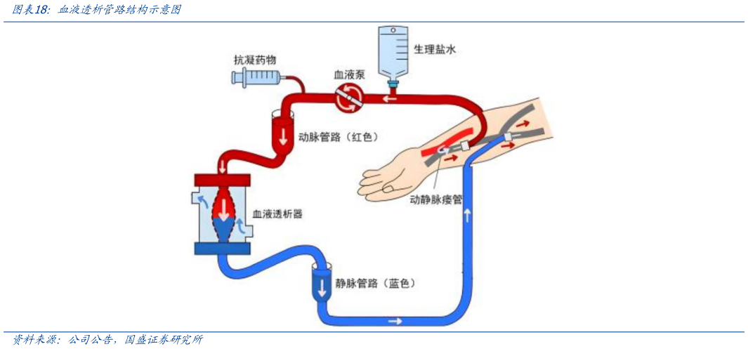 咨询下各位血液透析管路结构示意图