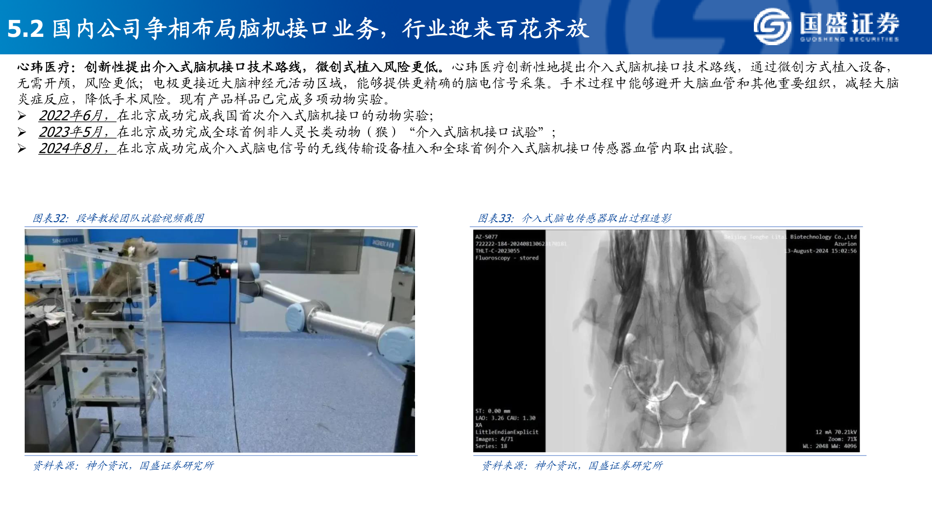 请问一下5.2 国内公司争相布局脑机接口业务，行业迎来百花齐放